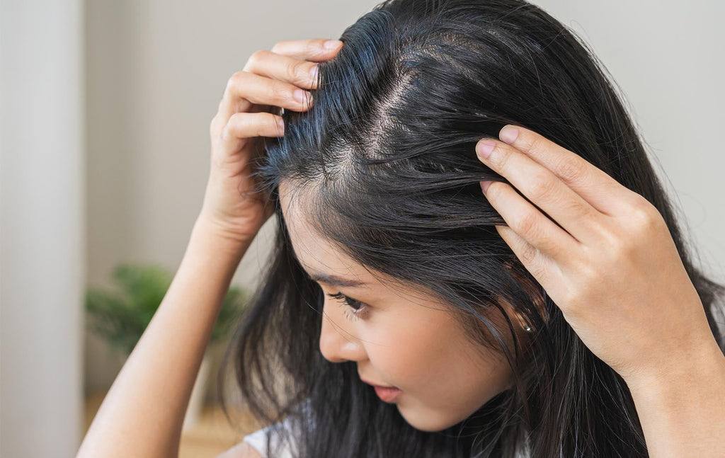 A woman inspecting her dry scalp